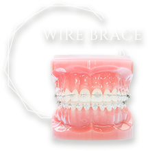 WIRE BRACE
